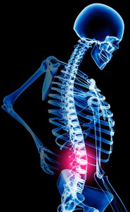 Back Pain on bone